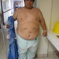 Endoscopia Gastrocirugia y OBESIDAD